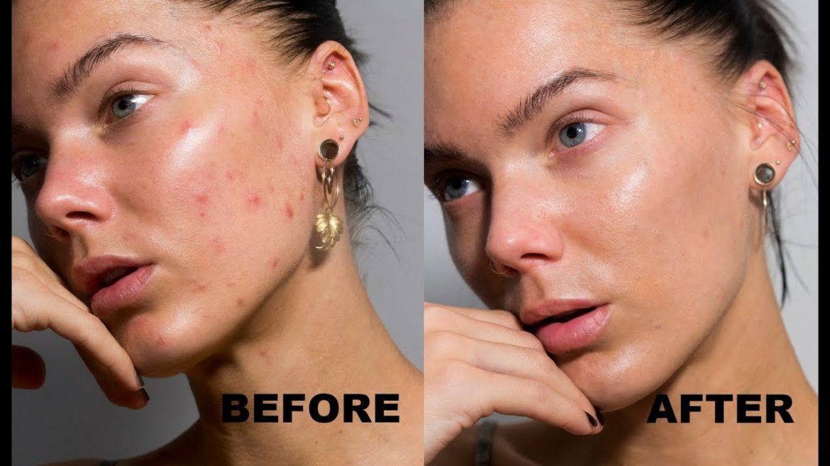 How to get rid of spots